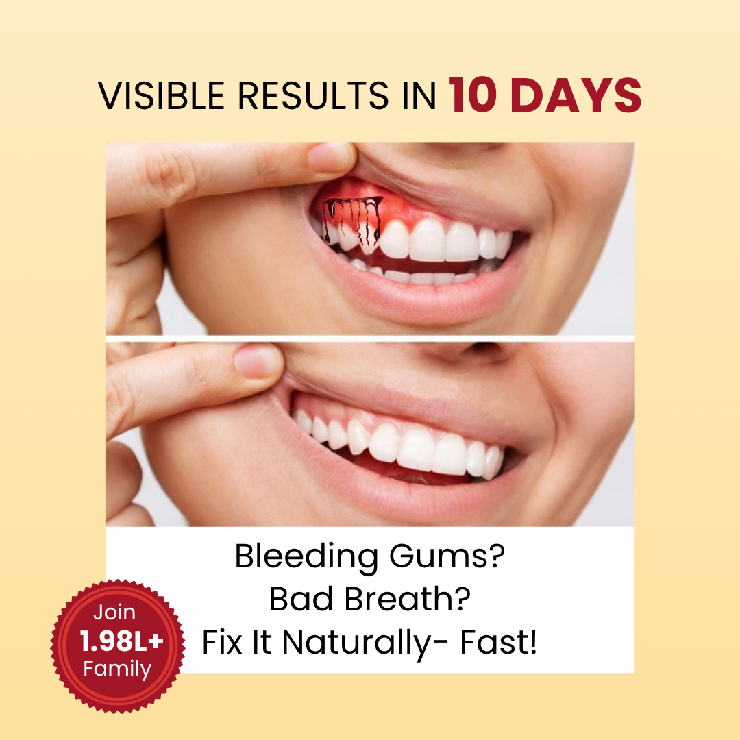 Happy Smile For Healthy Gums - 30 Ml