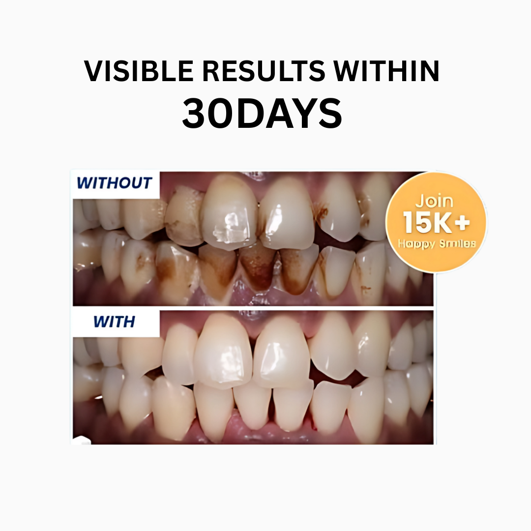 Happy Smile For Healthy Gums - 30 Ml