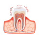 Relief From Teeth Sensitivity
